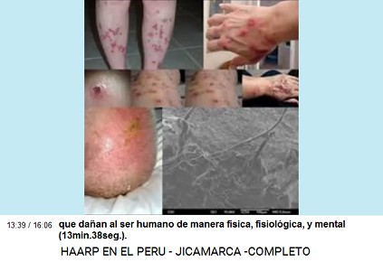 Un claro ejemplo est� en los aviones de
                          propulsi�n a chorro que sobrevuelan nuestro
                          cielo (13min.43seg.).