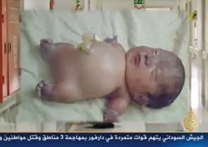 Niño deformado en Fallujah
por munición de uranio de la OTAN 01 Niño deformado
en Fallujah por munición de uranio de la
OTAN 01