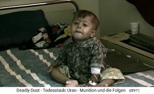 Child with radioactive NATO
damage from nuclear missile
("uranium ammunition") 01 Child with radioactive NATO damage
from nuclear missile ("uranium
ammunition") 01
