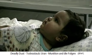 Child with radioactive NATO
damage from nuclear missile
("uranium ammunition") 02 Child with radioactive NATO damage
from nuclear missile ("uranium
ammunition") 02