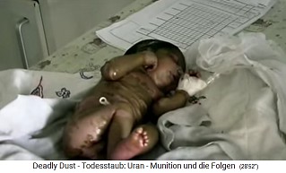 Child with radioactive NATO
damage from nuclear missile
("uranium ammunition") 03 Child with radioactive NATO damage
from nuclear missile ("uranium
ammunition") 03