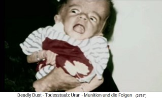 Child with radioactive NATO
damage from nuclear missile
("uranium ammunition") 05 Child with radioactive NATO damage
from nuclear missile ("uranium
ammunition") 05
