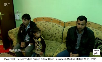 Iraq, a child Muhammad with
birth defect had first an external
bladder, now a fistula has formed 01 Iraq, a child Muhammad with birth
defect had first an external bladder,
now a fistula has formed 01