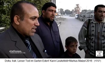 Iraq: A boy of 8
                                    years with leukemia