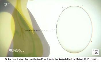 Der
                                    Trickfilm: Uranstaub gelangt in die
                                    Lunge