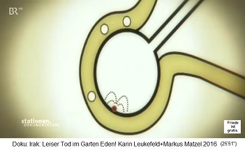 Cartoon: The uranium dust is
partially soluble and enters the
bloodstream, or settles in the lungs
radiating without end. Cartoon: The uranium dust is
partially soluble and enters the
bloodstream, or settles in the lungs
radiating without end.