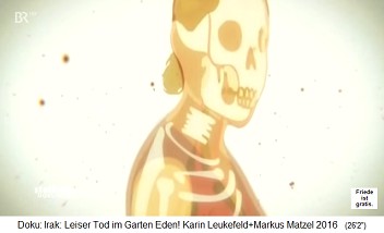 Trickfilm: Das Uran zerstrt
                                    Knochen und Knochenmark und
                                    provoziert so Leukmie