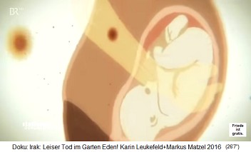 Cartoon: Uranium destroys
bones and the bone marrow, provoking
destroying fetuses and unborn babies
in pregnant women. Cartoon:
Uranium destroys bones and the bone
marrow, provoking destroying fetuses
and unborn babies in pregnant
women.