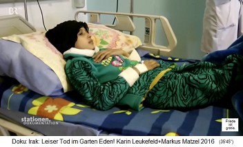 Basra (Irak): Im neuen
                                    Kinderkrankenhaus fr Krebskinder
                                    schaut eine Jugendliche fern