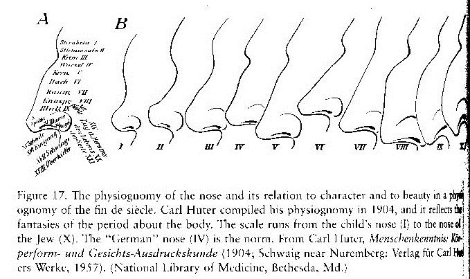 J�dische Nase mit heruntergezogener
                        Nasenspitze, Schema