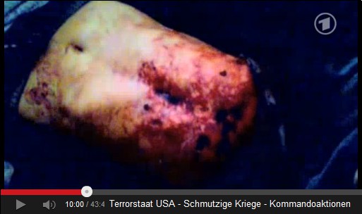 Die Einschüsse der Mörder-Amis bei
Mohammed Daoud 03 Die Einschüsse der Mörder-Amis bei Mohammed
Daoud 03