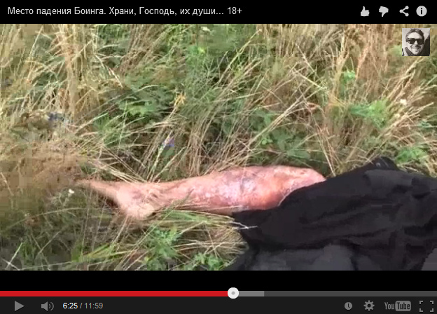 There is a leg of a dummy or of an actor in
                        the grass. The burning does not look fresh - and
                        all other "dead bodies" don't have
                        such burnings!