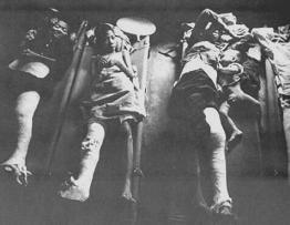 Vietnam war bomb victims
