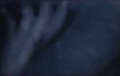 Hand of a German prisoner of war with
                      dysentery (23min. 54sec.)