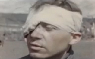 German prisoner of war with a bound
                              eye (24min. 14sec.)
