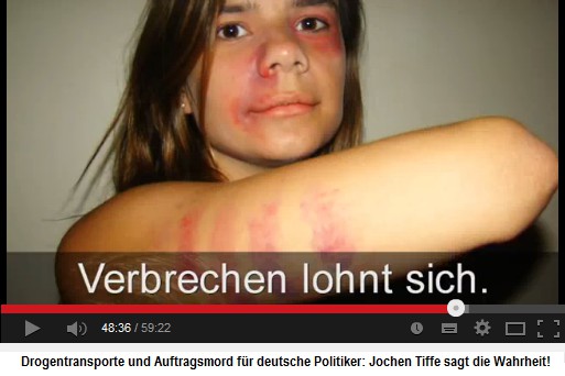 Frau mit Schlagspuren im Gesicht und
                          am Arm - die muslimischen und die linken
                          Schläger werden von der Kölner Justiz nie
                          bestraft