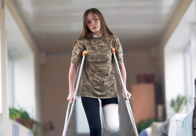 Nazi Ukraine March 11, 2023:
Ukrainian soldier Ruslana (19) loses a leg -
and many soldiers there have only 1 leg
left: Away from propaganda - THIS is war:
shell splinters tore off Ruslana's (19) left
leg Nazi Ukraine March 11, 2023:
Ukrainian soldier Ruslana (19) loses a leg -
and many soldiers there have only 1 leg
left: Away from propaganda - THIS is war:
shell splinters tore off Ruslana's (19) left
leg