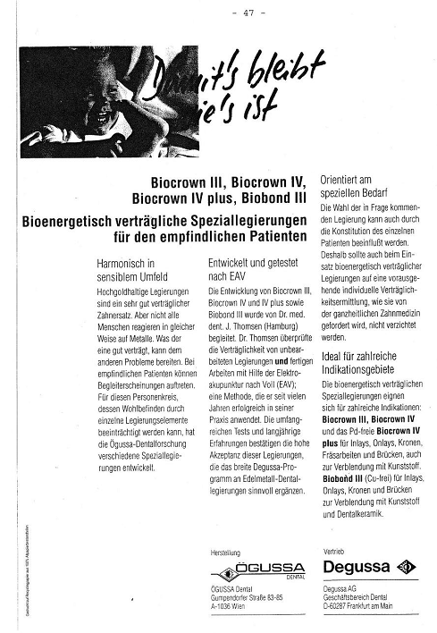 Werbungsanzeige
von Ögussa und Degussa für
Goldfüllungen für Patienten, die auf
Amalgam sensibel reagieren Werbungsanzeige von Ögussa und
Degussa für Goldfüllungen für
Patienten, die auf Amalgam sensibel
reagieren