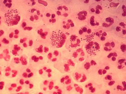 Microbios (aquí:
neisseria gonorrhoeae) pueden imitar antígenos y
por eso pueden trucar el sistema inmunológico
cuando la alimentación no corresponde con el
grupo sanguíneo. Microbios (aquí:
neisseria gonorrhoeae) pueden imitar antígenos y
por eso pueden trucar el sistema inmunológico
cuando la alimentación no corresponde con el
grupo sanguíneo.