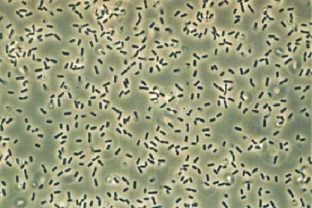 Bakterien wie Bacillus subtilis
                          ("Heubazillus") k�nnen durch
                          Farbbestrahlung abget�tet werden