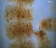 Rotalgen sind
                            deswegen rot, weil rotes Gewebe das
                            blau-gr�ne Meerwasserlicht besonders gut
                            ausn�tzen kann