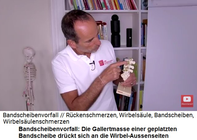Die Gallertmasse der
                      geplatzten Bandscheibe drckt sich an die
                      Wirbel-Aussenseiten