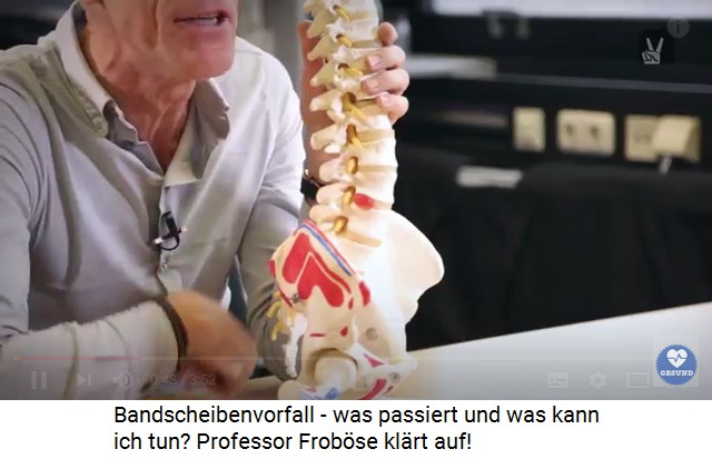 Dr. Ingo Frobse zeigt ein
                                    Modell einer Wirbelsule mit einem
                                    Bandscheibenvorfall (der rote
                                    Knubbel an einem der unteren,
                                    grossen Wirbel)