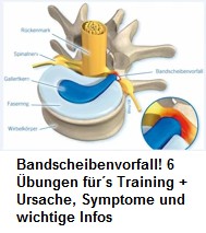 Bandscheibenvorfall: Der
                      Faserring ist gerissen, der Gallertkern gelangt
                      nach draussen und drckt auf einen Nerv - Schema
