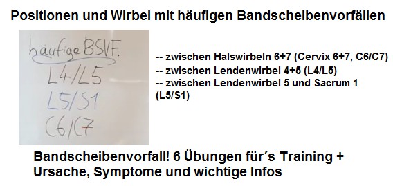 Die Positionen und
                      Wirbel mit den hufigsten Bandscheibenvorfllen