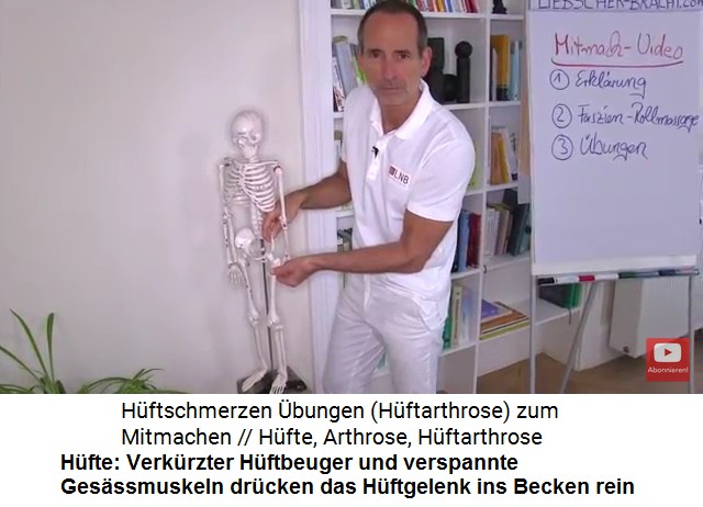 Liebscher-Bracht mit dem
                      Skelettmodell: Der verkrzte Hftbeuger und
                      verspannte Gesssmuskeln drcken das Hftgelenk
                      ins Becken rein