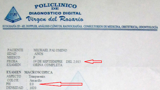 Reporte del laboratorio del 19 de
                          septiembre 2015 indicando un valor pH 8 en la
                          orina