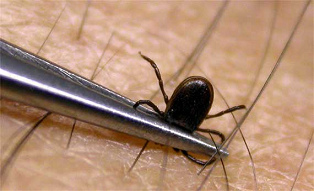 Eine
                      Zecke wird mit Pinzette von unten her entfernt.
                      Das Protein der Zecke scheint gleichzeitig eine
                      Wirkung gegen Krebszellen zu haben