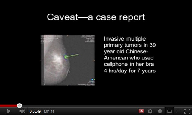 Krebs
                  durch Handy an der Brust