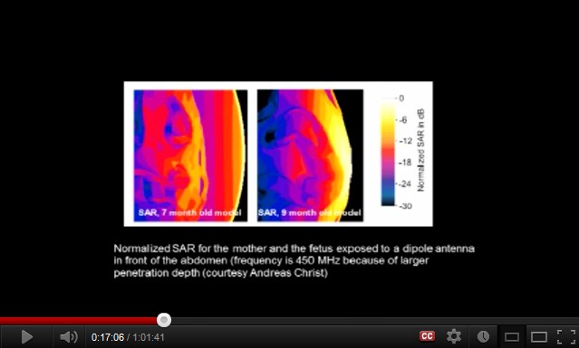 Ein
                  Handy an einem Bauch einer schwangeren Frau verstrahlt
                  den F�tus