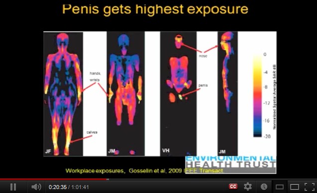 Am
                  meisten gef�hrdet sind die Gelenke, die Nase und die
                  m�nnlichen Geschlechtsorgane.